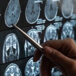 MRI Misdiagnosis: Common Errors and How to Avoid Them